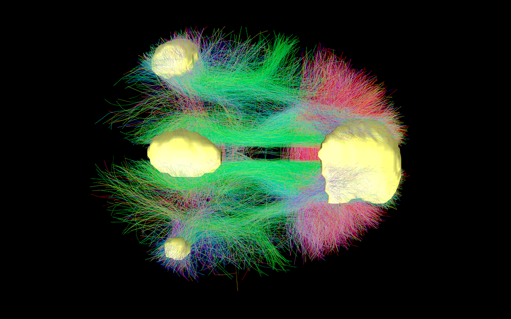 Default Mode Network Brain fMRI